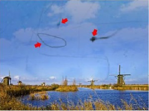 眼前,總,有小,黑影,晃動,飛蚊,癥,到底,要不要, 眼前,總,有小,黑影,晃動,飛蚊,癥,到底,要不要,