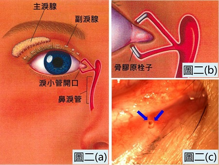 眼睛,總是,干,干的,干眼癥,可能,已經,盯上, 眼睛,總是,干,干的,干眼癥,可能,已經,盯上,