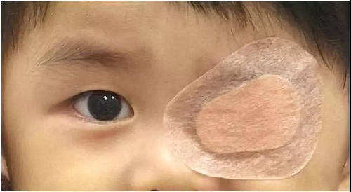 斜視,不僅,會,影響,兒童心理,發(fā)育,甚至,還會,