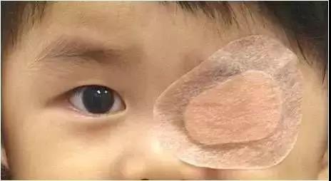 為什么,兒童,斜視,會,引起,弱視,要,怎么,治療, 為什么,兒童,斜視,會,引起,弱視,要,怎么,治療,