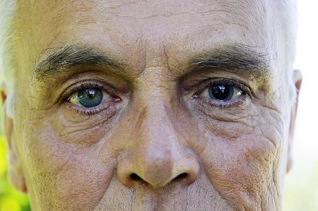 清光眼遺傳 清光眼遺傳