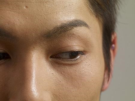 孩子斜視怎么辦,斜視的危害,小兒斜視治療 孩子斜視怎么辦,斜視的危害,小兒斜視治療