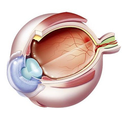 糖尿病,黃斑水腫,黃斑水腫原因,黃斑水腫癥狀,黃 糖尿病,黃斑水腫,黃斑水腫原因,黃斑水腫癥狀,黃