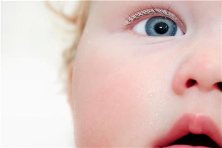 孩子流眼淚怎么辦,小兒淚道阻塞治療,先天性淚道 孩子流眼淚怎么辦,小兒淚道阻塞治療,先天性淚道