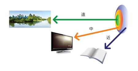 白內障手術矯正屈光不正,人工晶體的作用,人工晶