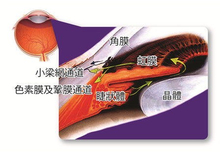 青光眼,青光眼注意事項,青光眼治療 青光眼,青光眼注意事項,青光眼治療