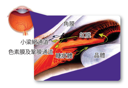 眼壓是什么,眼壓異常,青光眼眼壓,青光眼治療