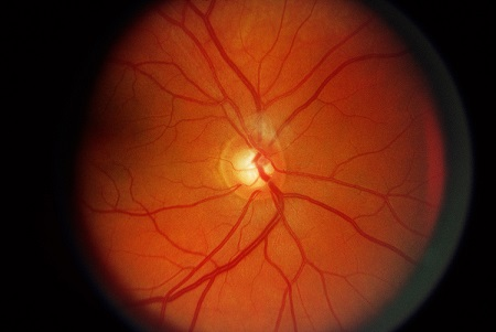 手機輻射,用眼過度,關燈玩手機,干眼癥 手機輻射,用眼過度,關燈玩手機,干眼癥