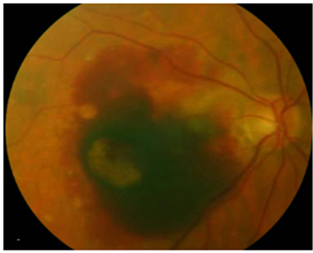 防紫外線,太陽鏡,墨鏡怎么選,防曬