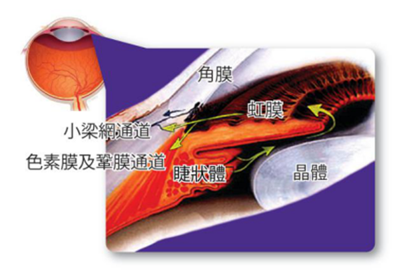 青光眼,關(guān)燈玩手機(jī),青光眼癥狀,青光眼治療