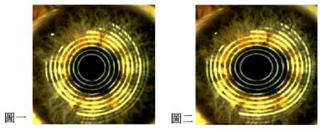 兒童散光,散光矯正,散光配鏡,散光怎么辦