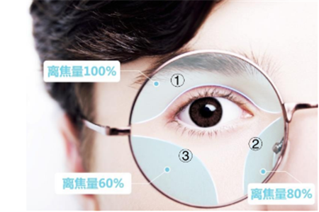 兒童近視,小兒近視,兒童配鏡,角膜塑形鏡 兒童近視,小兒近視,兒童配鏡,角膜塑形鏡