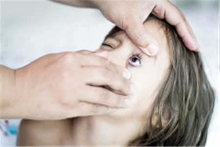 結膜炎,過敏性結膜炎,眼睛過敏怎么辦,過敏性結 結膜炎,過敏性結膜炎,眼睛過敏怎么辦,過敏性結