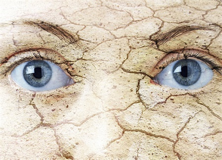 干眼癥,干眼癥癥狀,干眼癥成因,干眼癥治療 干眼癥,干眼癥癥狀,干眼癥成因,干眼癥治療