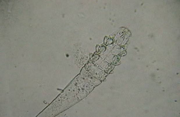 結膜,眼角膜 結膜,眼角膜