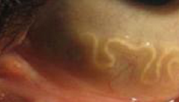 結膜,眼角膜 結膜,眼角膜