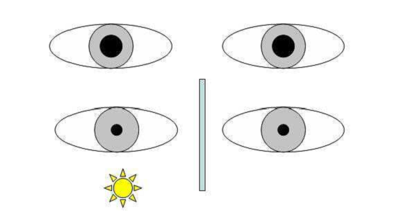 視網膜,近視,晶狀體 視網膜,近視,晶狀體